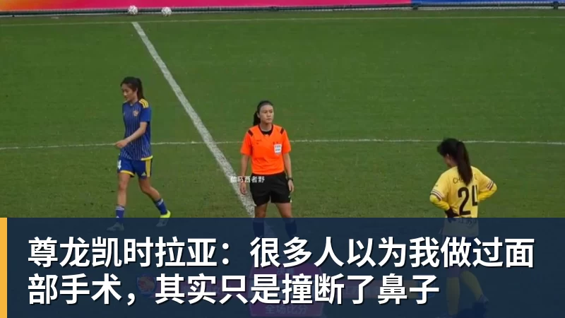 尊龙凯时拉亚：很多人以为我做过面部手术，其实只是撞断了鼻子
